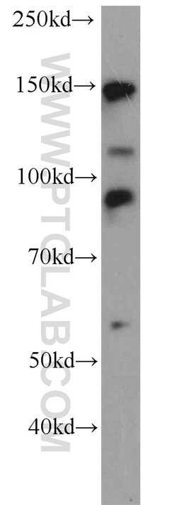 TCERG1 Rabbit anti-Human, Mouse, Rat, Polyclonal, Proteintech 150 &mu;L;