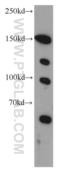 TCERG1 Rabbit anti-Human, Mouse, Rat, Polyclonal, Proteintech 150 &mu;L;