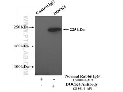 DOCK4 Rabbit anti-Human, Polyclonal, Proteintech 20 &mu;L; Unconjugated:Antibodies,