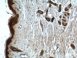 CCHCR1 Rabbit anti-Human, Polyclonal, Proteintech:Antibodies:Primary Antibodies