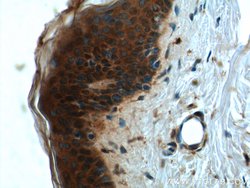 CCHCR1 Rabbit anti-Human, Polyclonal, Proteintech:Antibodies:Primary Antibodies