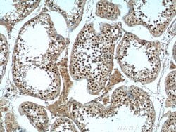 CCHCR1 Rabbit anti-Human, Polyclonal, Proteintech:Antibodies:Primary Antibodies