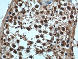 CCHCR1 Rabbit anti-Human, Polyclonal, Proteintech:Antibodies:Primary Antibodies