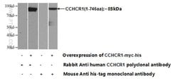 CCHCR1 Rabbit anti-Human, Polyclonal, Proteintech:Antibodies:Primary Antibodies