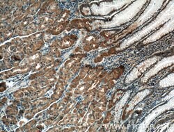 THAP10 Rabbit anti-Human, Mouse, Polyclonal, Proteintech:Antibodies:Primary