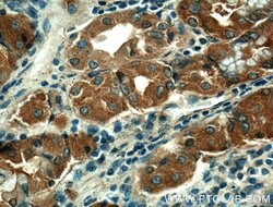 THAP10 Rabbit anti-Human, Mouse, Polyclonal, Proteintech:Antibodies:Primary