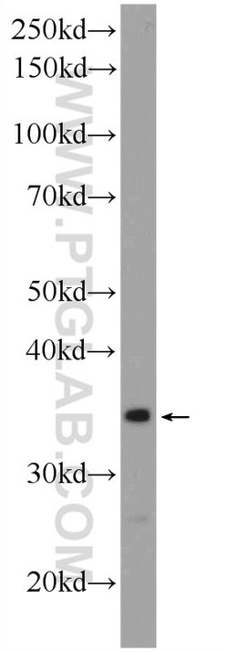 THAP10 Rabbit anti-Human, Mouse, Polyclonal, Proteintech:Antibodies:Primary