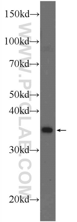 THAP10 Rabbit anti-Human, Mouse, Polyclonal, Proteintech:Antibodies:Primary