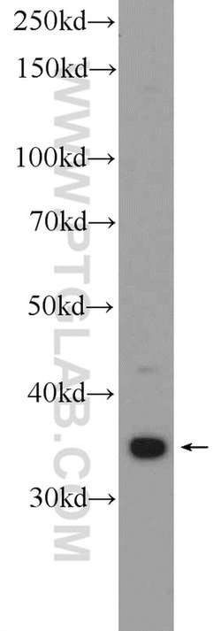 THAP10 Rabbit anti-Human, Mouse, Polyclonal, Proteintech:Antibodies:Primary