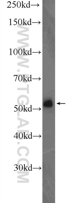 KIAA0141 Rabbit anti-Human, Mouse, Polyclonal, Proteintech:Antibodies:Primary