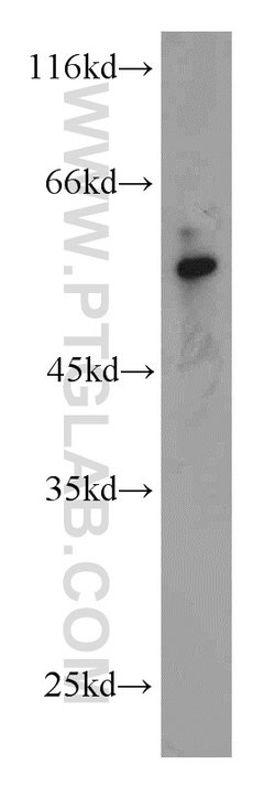 KIAA0141 Rabbit anti-Human, Mouse, Polyclonal, Proteintech:Antibodies:Primary
