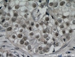 ZBTB38 Rabbit anti-Human, Polyclonal, Proteintech 150 &mu;L; Unconjugated:Antibodies,