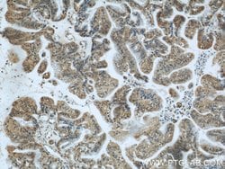 ZBTB38 Rabbit anti-Human, Polyclonal, Proteintech 150 &mu;L; Unconjugated:Antibodies,