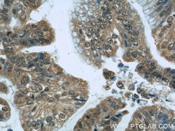 ZBTB38 Rabbit anti-Human, Polyclonal, Proteintech 150 &mu;L; Unconjugated:Antibodies,