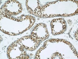 ZBTB38 Rabbit anti-Human, Polyclonal, Proteintech 150 &mu;L; Unconjugated:Antibodies,