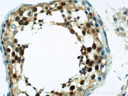 ZBTB38 Rabbit anti-Human, Polyclonal, Proteintech 150 &mu;L; Unconjugated:Antibodies,