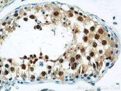 ZBTB38 Rabbit anti-Human, Polyclonal, Proteintech 150 &mu;L; Unconjugated:Antibodies,