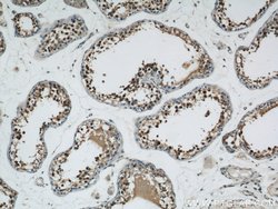 ZBTB38 Rabbit anti-Human, Polyclonal, Proteintech 150 &mu;L; Unconjugated:Antibodies,