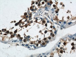 ZBTB38 Rabbit anti-Human, Polyclonal, Proteintech 150 &mu;L; Unconjugated:Antibodies,