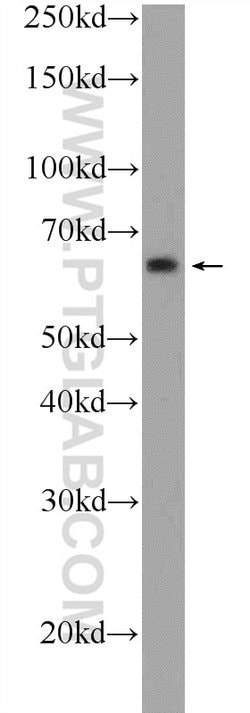 ONECUT2 Rabbit anti-Human, Mouse, Polyclonal, Proteintech 150 &mu;L; Unconjugated:Antibodies,