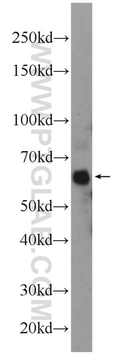 ONECUT2 Rabbit anti-Human, Mouse, Polyclonal, Proteintech 150 &mu;L; Unconjugated:Antibodies,