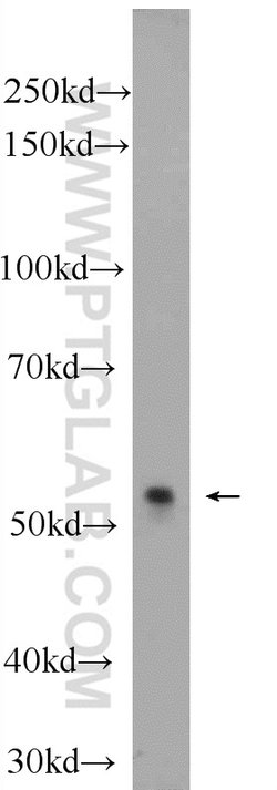 ONECUT2 Rabbit anti-Human, Mouse, Polyclonal, Proteintech 150 &mu;L; Unconjugated:Antibodies,