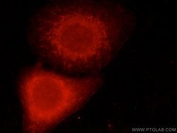LGI3 Rabbit anti-Human, Mouse, Rat, Polyclonal, Proteintech:Antibodies:Primary