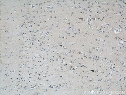 LGI3 Rabbit anti-Human, Mouse, Rat, Polyclonal, Proteintech:Antibodies:Primary