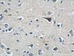 LGI3 Rabbit anti-Human, Mouse, Rat, Polyclonal, Proteintech:Antibodies:Primary