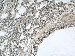 LGI3 Rabbit anti-Human, Mouse, Rat, Polyclonal, Proteintech:Antibodies:Primary