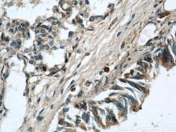 LGI3 Rabbit anti-Human, Mouse, Rat, Polyclonal, Proteintech:Antibodies:Primary