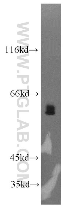 LGI3 Rabbit anti-Human, Mouse, Rat, Polyclonal, Proteintech:Antibodies:Primary