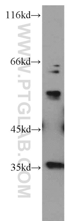 LGI3 Rabbit anti-Human, Mouse, Rat, Polyclonal, Proteintech:Antibodies:Primary