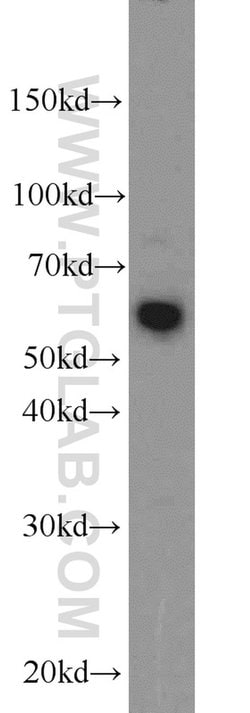 LGI3 Rabbit anti-Human, Mouse, Rat, Polyclonal, Proteintech:Antibodies:Primary