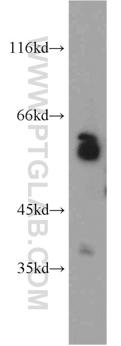 LGI3 Rabbit anti-Human, Mouse, Rat, Polyclonal, Proteintech:Antibodies:Primary