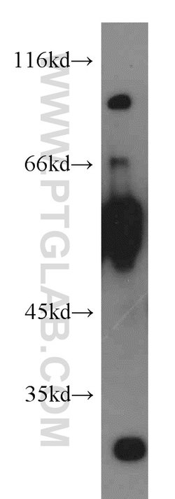 LGI3 Rabbit anti-Human, Mouse, Rat, Polyclonal, Proteintech:Antibodies:Primary