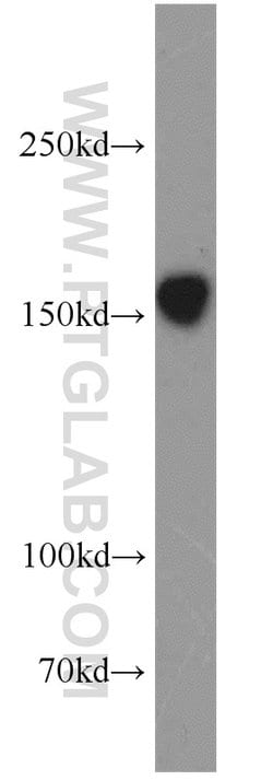 GRIN2B Rabbit anti-Human, Mouse, Rat, Polyclonal, Proteintech:Antibodies:Primary