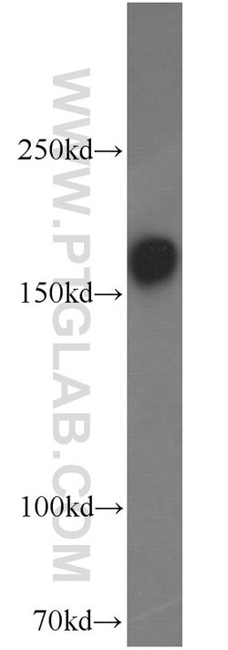 GRIN2B Rabbit anti-Human, Mouse, Rat, Polyclonal, Proteintech:Antibodies:Primary