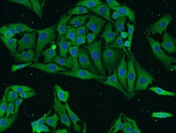 GRIN2B Rabbit anti-Human, Mouse, Rat, Polyclonal, Proteintech:Antibodies:Primary