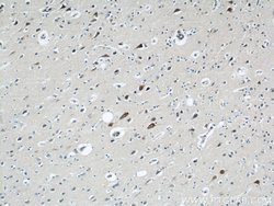 GRIN2B Rabbit anti-Human, Mouse, Rat, Polyclonal, Proteintech:Antibodies:Primary