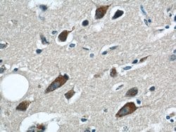 GRIN2B Rabbit anti-Human, Mouse, Rat, Polyclonal, Proteintech:Antibodies:Primary