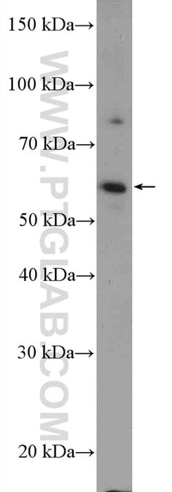 KIAA0895 Rabbit anti-Human, Mouse, Polyclonal, Proteintech:Antibodies:Primary