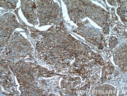 POLD3 Rabbit anti-Human, Mouse, Polyclonal, Proteintech 150 &mu;L; Unconjugated:Antibodies,