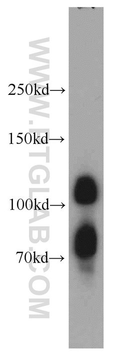 DNAJC6/AUXILIN Rabbit anti-Human, Mouse, Rat, Polyclonal, Proteintech 150