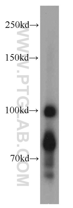DNAJC6/AUXILIN Rabbit anti-Human, Mouse, Rat, Polyclonal, Proteintech 150