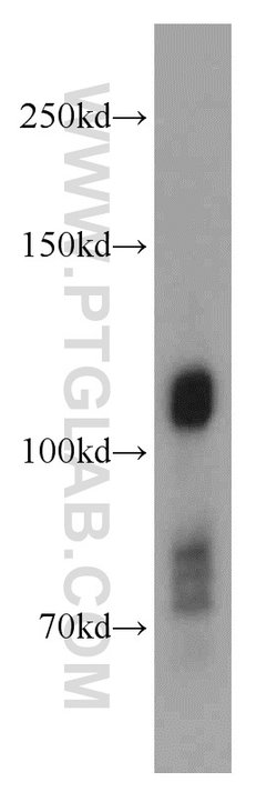 DNAJC6/AUXILIN Rabbit anti-Human, Mouse, Rat, Polyclonal, Proteintech 150