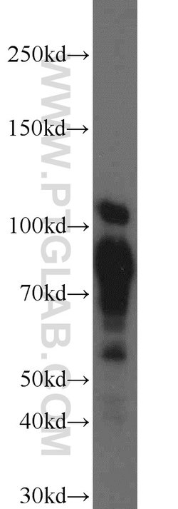 DNAJC6/AUXILIN Rabbit anti-Human, Mouse, Rat, Polyclonal, Proteintech 150