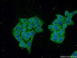 DNAJC6/AUXILIN Rabbit anti-Human, Mouse, Rat, Polyclonal, Proteintech 150