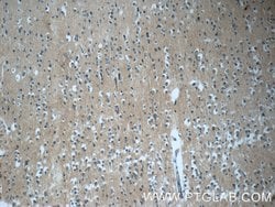 DNAJC6/AUXILIN Rabbit anti-Human, Mouse, Rat, Polyclonal, Proteintech 150