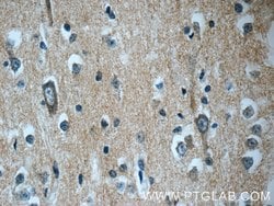 DNAJC6/AUXILIN Rabbit anti-Human, Mouse, Rat, Polyclonal, Proteintech 150